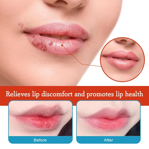 Vista 2 de Labios secos y agrietados, bálsamo labial curativo natural, crema orgánica para tratamiento de queilitis humectante durante todo el día, hombres