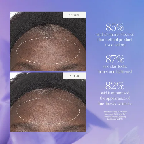 Vista 4 de KORA Organics Hidratante alternativo al retinol de células madre vegetales, alternativa activa al retinol suaviza las arrugas y reafirma la piel