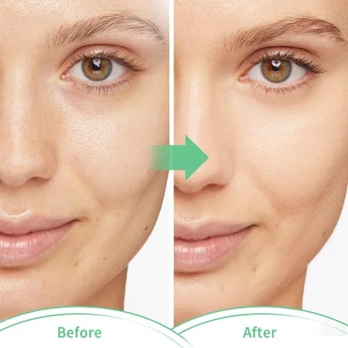 Vista 7 de Máscaras faciales frías, máscara facial de hielo, compresa fría y caliente, ojeras, hinchazón, migrañas y dolor de cabeza, enfriamiento