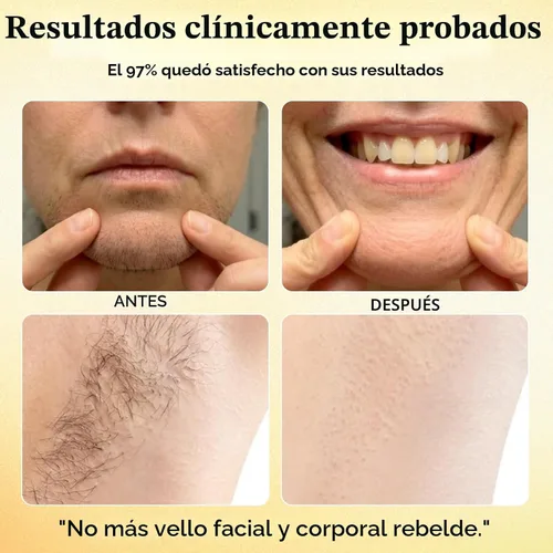 Vista 2 de Renovia Cyperus Rotundus Aceite para depilación, nuevo suero de piel Renovia Cyperus Rotundus 2026, minimizador de poros, hidratante y calmante