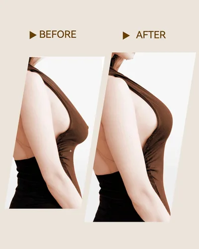 Vista 7 de Niidor Boob Tape for Breast Lift, Push Up Breast Tape for Large Breast with Nipple Cover for Women, Pasties with Travel Case
