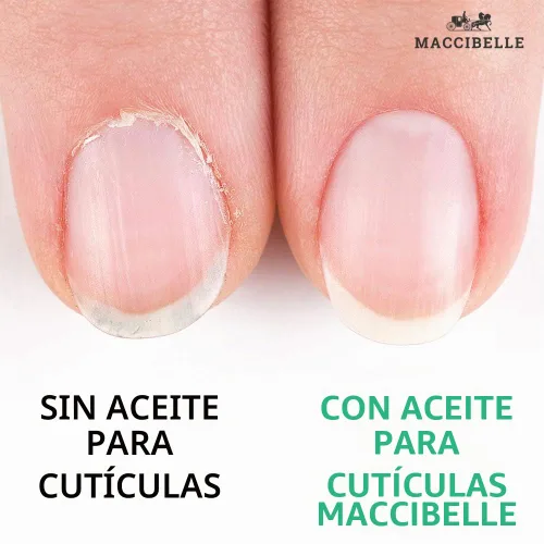 Vista 2 de Aceite de cutícula para uñas, tamaño de recambio para cutículas secas agrietadas (8 onzas, piña)