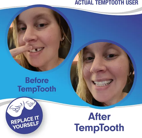 Vista 3 de El producto de sustitución dentaria temporal n.'º 1 en ventas, con herramientas dentales gratuitas, de Temptooth