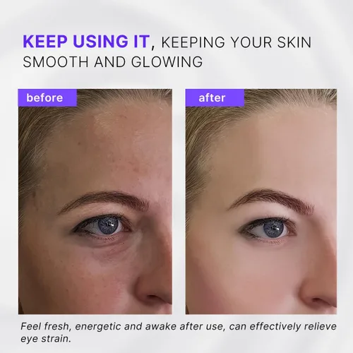 Vista 5 de Rodillo de ojos, masajeador facial con rodillo – Reduce la hinchazón, ojeras, terapia de enfriamiento para ojos cansados (con aplicador)