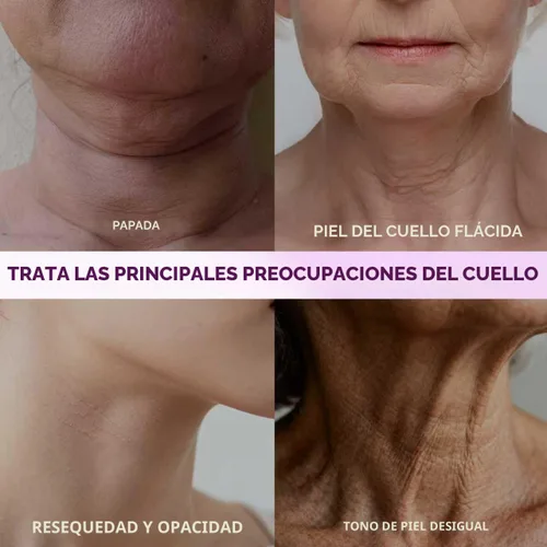 Vista 4 de Crema reafirmante para el cuello con retinol, AH-8 Hexapéptido Colágeno, reafirma la piel flácida en el cuello y escote, promueve la reparación