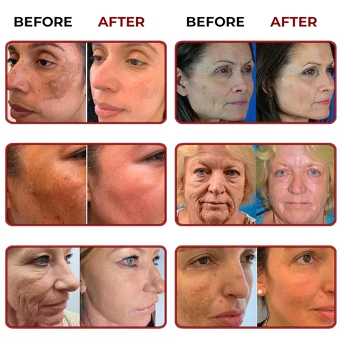Vista 6 de ABERA Suero de azafrán renovador, tratamiento de melasma de alta potencia para cara y cuerpo, removedor de manchas oscuras para la edad, pecas