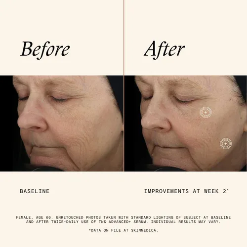 Vista 4 de SkinMedica TNS Advanced+ - Suero facial multipéptido para ayudar a mejorar la apariencia de arrugas, líneas finas, tono de piel y textura (1 oz)