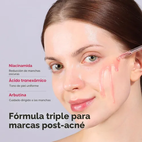 Vista 2 de TOSOWOONG Suero de Niacinamida 10% + Ácido Tranexámico 4%, Arbutina 2%, Ácido Hialurónico, Suero Facial TXA, Piel de Vidrio, Clarificante, Complejo