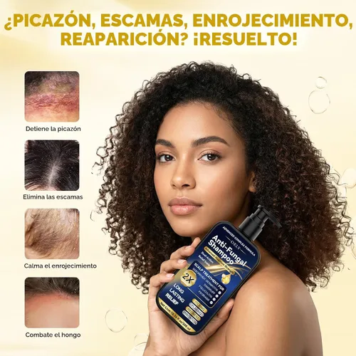 Vista 2 de Champú antifúngico mejorado para dermatitis seborreica, foliculitis y psoriasis del cuero cabelludo, champú anticaspa para hombres y mujeres, alivia
