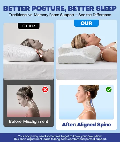 Vista 4 de Emircey Almohada cervical para el cuello cervical de alivio de nivel clínico para dormir, almohada ortopédica de espuma viscoelástica para dormir