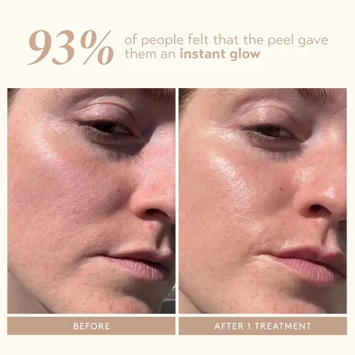 Vista 5 de SHANI DARDEN SKIN CARE Exfoliante Triple Ácido, Exfoliante Facial de 2 Pasos con Ácidos Mandélico, Láctico y Glicólico, Mascarilla Neutralizante