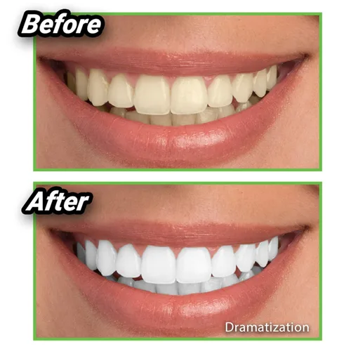 Vista 4 de Ontel Miracle Teeth Whitener - Polvo de carbón de coco blanqueador natural, como se ve en la televisión