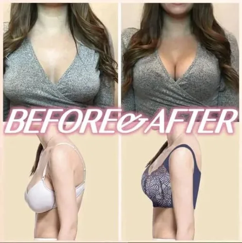 Vista 8 de BEROZA Prettyhealth - Brasier de levantamiento potente para desintoxicación linfática, moldeador y levantamiento potente, brasier de turmalina