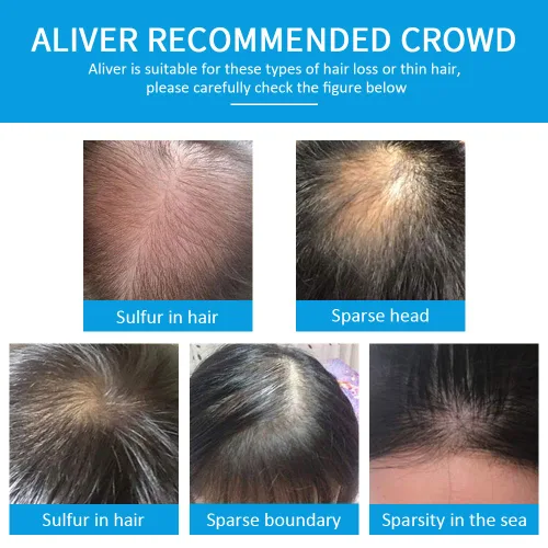 Vista 6 de ELAIMEI Fibras de cabello negro para cabello fino, fórmula natural, polvo sin perfume, negro, unisex, adultos, hombres y mujeres