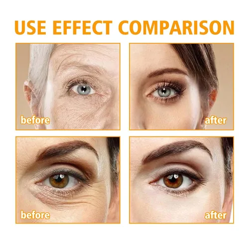 Vista 6 de Crema de ojos con péptido 5D, crema reparadora de ojos antienvejecimiento para ojeras e hinchazón, reducción diaria de arrugas, hidratante ligero
