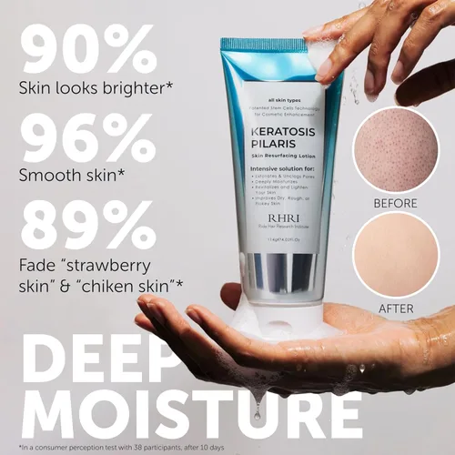 Vista 2 de Tratamiento de queratosis pilaris Loción de queratosis pilaris con 10% AHA Exfoliación suave para piernas de fresa, KP y pelos encarnados