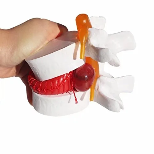 Vista 4 de DENTAL Color blanco oral 1:1.5 vértebras lumbares humanas anatómicas degenerativas lumbares modelo de columna vertebral humana US Stock