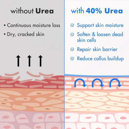 Vista 5 de Ebanel Crema de urea 40% más ácido salicílico, paquete de 3 unidades de crema para pies secos agrietados para pies agrietados, talones, rodillas