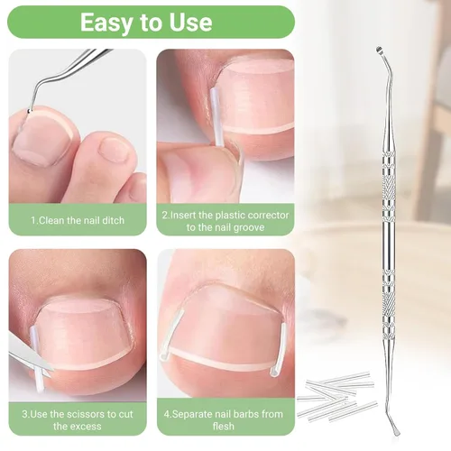 Vista 5 de Juego de corrector de uñas encarnadas con tiras correctoras, kit de herramientas profesionales para uñas de los pies, incluye tiras transpirables