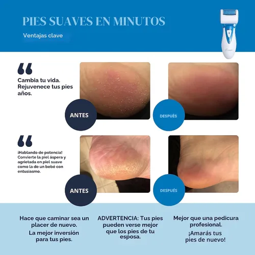 Vista 2 de Removedor de callos eléctrico recargable CR900 por propia armonía (probado más potente) mejores herramientas de pedicura con 2 rodillos, profesional