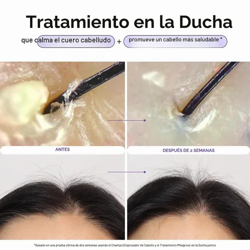 Vista 2 de Dr. Groot Miracle in Shower - Tratamiento hidratante para la pérdida del cabello, enjuague coreano para el cuidado del cabello, aceite de romero