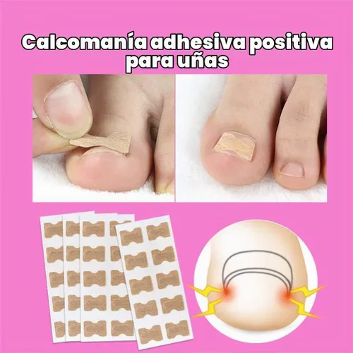 Vista 9 de Parche de corrección de uñas encarnadas, 50 calcomanías de uñas encarnadas sin pegamento para uñas encarnadas curvadas para el cuidado de los pies