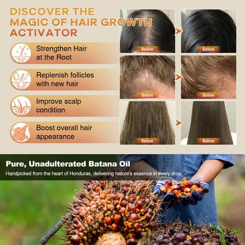 Vista 4 de Grossty Batana Oil Mascarilla para cabello seco y dañado Promueve el crecimiento saludable Nutrición profunda y reparación Estimula