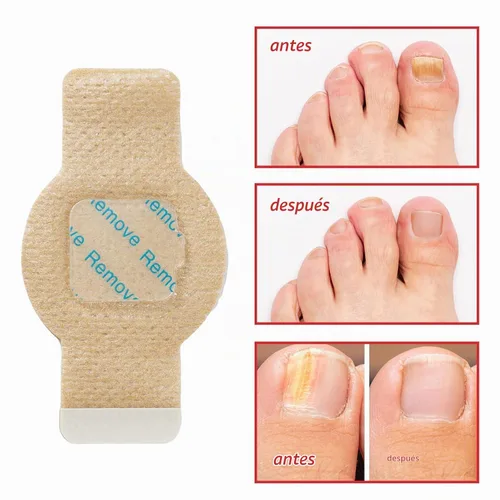 Vista 7 de Parches de uñas, parches de uñas para uñas de los pies, parches de tratamiento de uñas extra fuertes, yesos de uñas extra fuertes de 8 horas