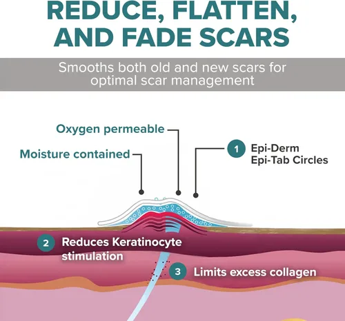 Vista 4 de Epi-Derm Epi-Tab Circles - Láminas de silicona para cicatrices – Parches de silicona lavables y reutilizables de grado profesional, para pequeñas