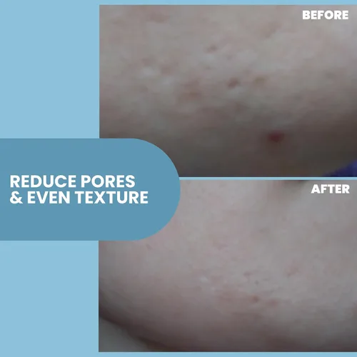 Vista 3 de Eva Naturals Suero reafirmante de la piel de (1 oz), suero de día o noche reafirma instantáneamente la piel suelta y afina las arrugas
