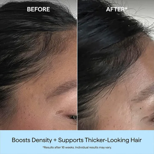 Vista 4 de Briogeo Destinado a la densidad de cafeína + suero de densidad de péptidos de biotina Aumenta el grosor y el volumen del cabello para cabello fino