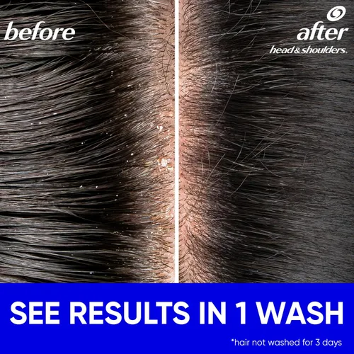 Vista 4 de Head & Shoulders Classic Clean Champú anticaspa, protección contra la caspa de 72 horas, 1% de piritiona de zinc, 28.2 onzas líquidas