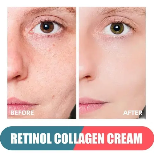 Vista 3 de Crema de retinol para cara con ácido hialurónico, hidratante antienvejecimiento de día y noche para mujeres y hombres, crema de colágeno