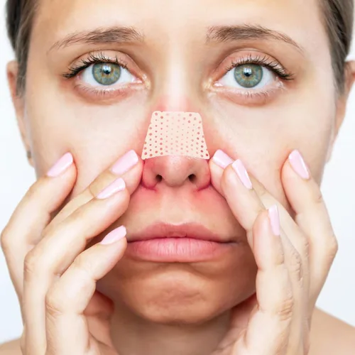 Vista 8 de 2pcs Beige Resin Nasal Support Protector for Nose Shaping
