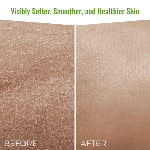 Vista 8 de Gel de baño orgánico - Gel de baño hidratante para piel sensible y alivio de la picazón - Gel de baño exfoliante para hombres y mujeres