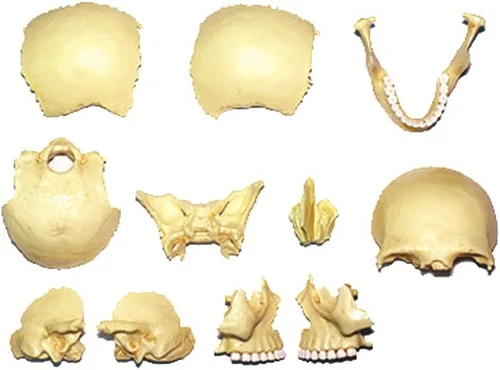 Vista 4 de 4D Master 26086 - Rompecabezas 3D de anatomía humana con diseño de calavera explosiva, un