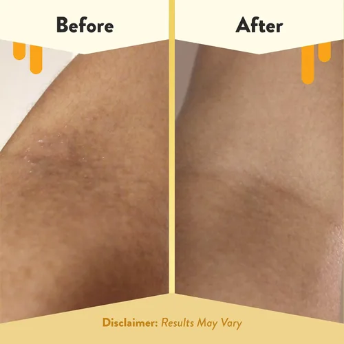Vista 4 de ECZEMA HONEY Baño de burbujas cómodo de avena sin fragancia, gel de baño y baño para piel sensible, productos de baño hidratantes, baño de burbujas