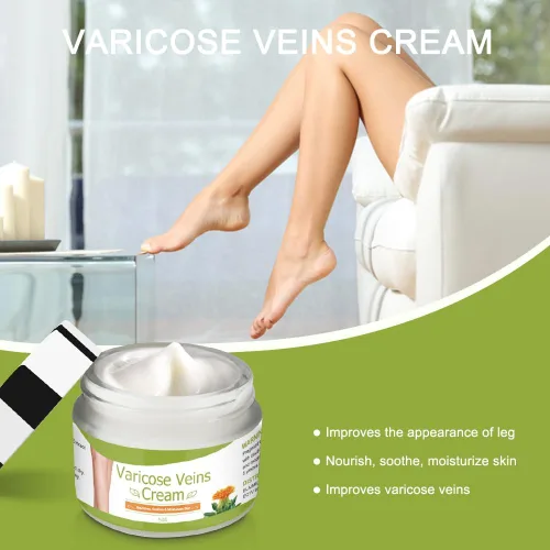 Vista 3 de Crema para venas varicosas, crema corporal, crema natural y pura para venas varicosas para piernas elimina las venas varicosas y las arañas