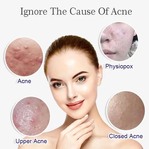Vista 2 de AICHUN BEAUTY Suero facial Extracto de arroz natural Hidratante Anti-Acné Anti-Oxidación Refine Arrugas 1.4 fl oz/1.35fl.oz