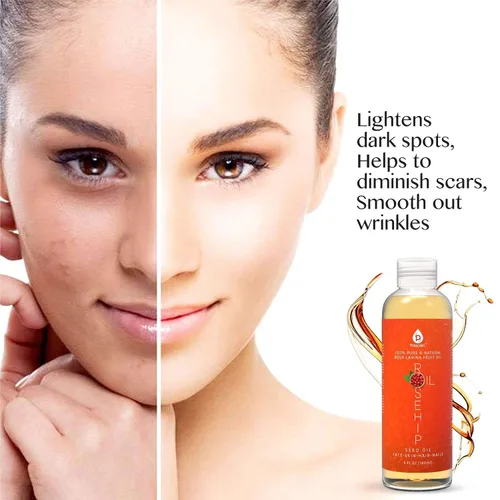 Vista 5 de Pursonic Aceite de rosa mosqueta 100% puro prensado en frío – 6 onzas líquidas de aceite facial hidratante para cara, cabello, piel y uñas