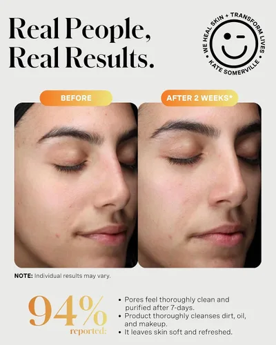 Vista 6 de Kate Somerville ExfoliKate Limpiador – Lavado facial exfoliante espumante diario – Exfoliante facial suave con ácido glicólico y ácido láctico