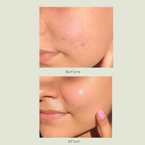 Vista 3 de Matter of Monday Lavado facial minimizador de poros - Limpiador exfoliante con enzimas de frutas y bambú - Limpiador facial diario para piel grasa