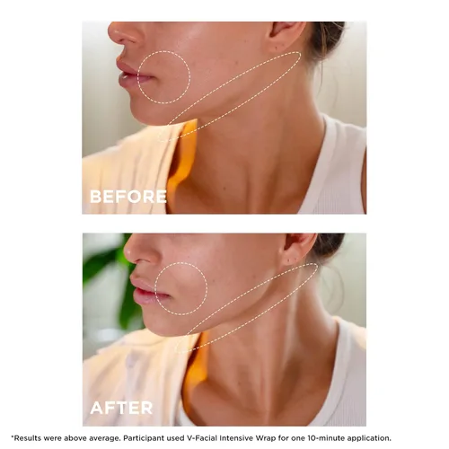 Vista 4 de Clarins Máscara facial intensiva V-Facial Mascarilla de contorno facial galardonada Reduce visiblemente la hinchazón y la hinchazón causadas por