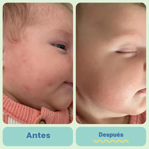 Vista 4 de Tubby Todd Ungüento completo, crema para eccema de bebé para pieles sensibles Crema multiusos para aliviar la piel del bebé para piel seca, sin