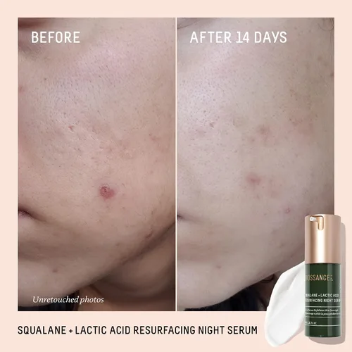 Vista 2 de Biossance Squalane + suero de noche rejuvenecedor con ácido láctico, 10% vegano, suero facial de ácido láctico para textura de la piel y líneas