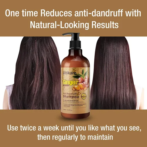 Vista 2 de Champú de jengibre para el cabello caspa, tratamiento anticaspa, champú para el cuidado del cuero cabelludo seco con picazón, aceite de extracto