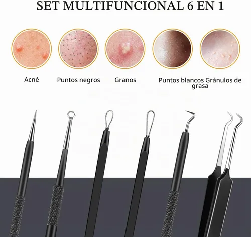 Vista 2 de Boxoyx Kit de herramientas para reventar espinillas, kit de herramientas extractoras de comedones de 6 piezas con estuche de metal para eliminar