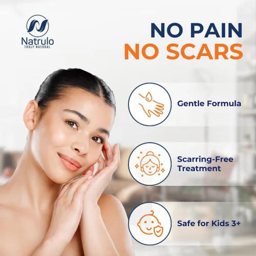 Vista 5 de Tratamiento natural para eliminar verrugas, gotas líquidas, rápido, seguro para niños, ungüento para eliminar verrugas de máxima fuerza con aceites