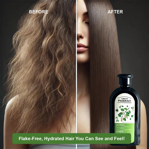 Vista 3 de Champú anticaspa de brotes de abedul y aceite de ricino 11.83 onzas líquidas Fortalece el cabello, hidrata y combate la caspa. Ingredientes
