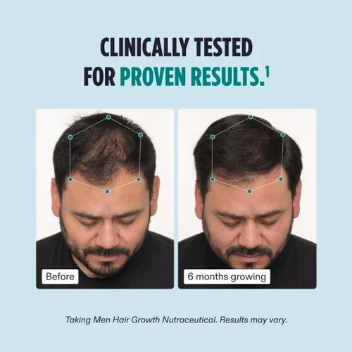 Vista 4 de Nutrafol Suplemento para el crecimiento del cabello para hombres y suero para el cabello, clínicamente probado para grosor y fuerza visibles